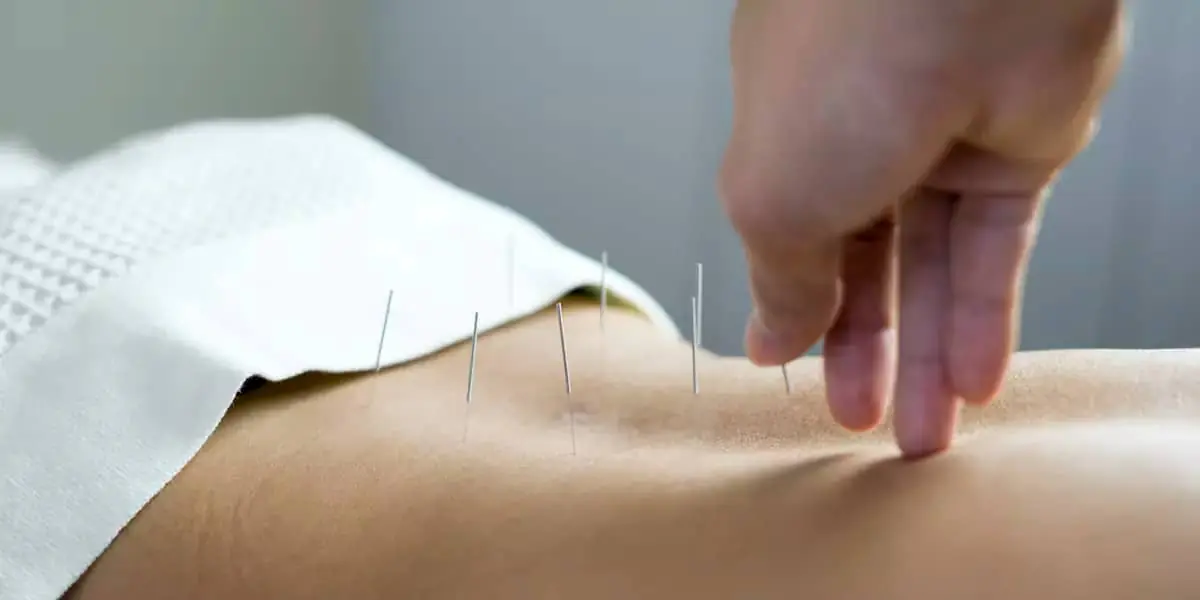 IMS-Intramuscular-Stimulation_2
